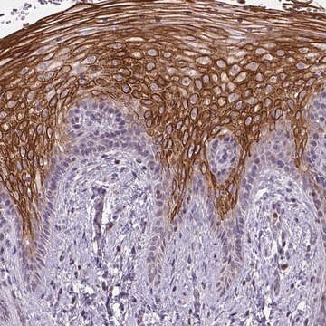 Anty-NUDT3 Prestige Antibodies&#174; Powered by Atlas Antibodies, affinity isolated antibody, buffered aqueous glycerol solution