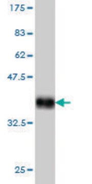 Monoclonal Anti-SHOX2 antibody produced in mouse clone 1D1, purified immunoglobulin, buffered aqueous solution