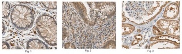 Anti-Corticotropin-Releasing Factor Receptor 2 Antibody 1.0&#160;mg/mL, from rabbit