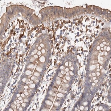 Anti-WDTC1 antibody produced in rabbit Prestige Antibodies&#174; Powered by Atlas Antibodies, affinity isolated antibody, buffered aqueous glycerol solution, ab3