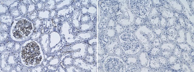 Anti-Adiponectin Antibody, clone 1D19 ZooMAb&#174; Rabbit Monoclonal recombinant, expressed in HEK 293 cells