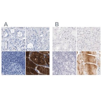 Anti-MYBPC1 antibody produced in rabbit Prestige Antibodies&#174; Powered by Atlas Antibodies, affinity isolated antibody, buffered aqueous glycerol solution