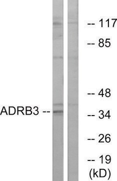 抗 ADRB3 兔抗 affinity isolated antibody