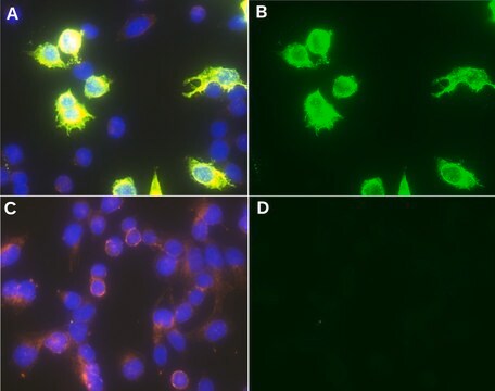 Anti-Measles Antibody, nucleoprotein, clone 83KKII clone 83KKII, Chemicon&#174;, from mouse