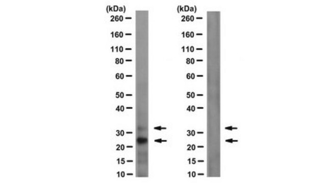 Anticorps anti-H2AK15ub, clone EDL H2AK15-4 clone EDL H2AK15-4, from mouse