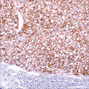 Carbonic Anhydrase IX (CA IX) (EP161) Rabbit Monoclonal Primary Antibody