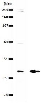 Anti-SETD8 (hPR-SET7) Antibody from rabbit, purified by affinity chromatography