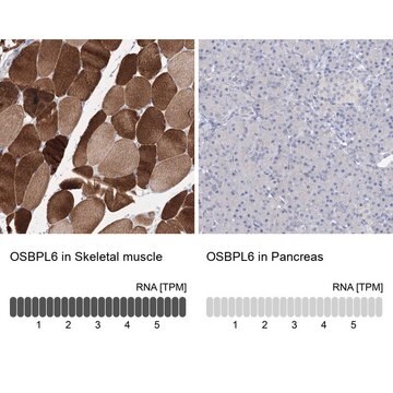 Anti-OSBPL6 antibody produced in rabbit Prestige Antibodies&#174; Powered by Atlas Antibodies, affinity isolated antibody, buffered aqueous glycerol solution