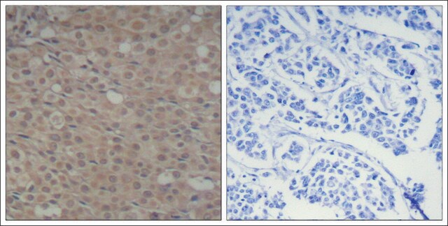 Anti-phospho-SMAD3 (pSer425) antibody produced in rabbit affinity isolated antibody