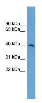 Anti-SUV39H2 antibody produced in rabbit affinity isolated antibody