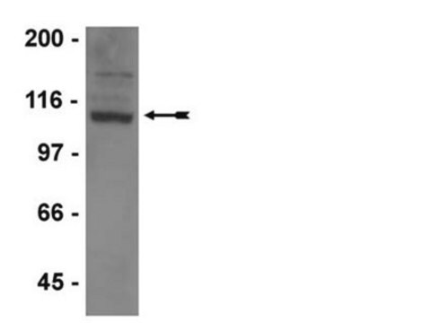 Anticuerpo anti-GluR1, clon C3T, monoclonal de conejo culture supernatant, clone C3T, Upstate&#174;