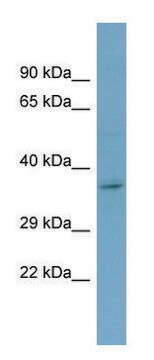 Anti-GHR (C-terminal) antibody produced in rabbit affinity isolated antibody