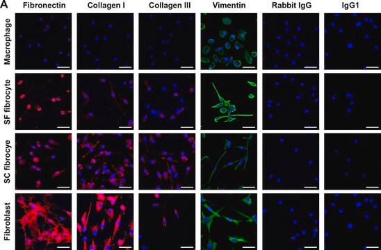 Anti-Fibronectin antibody produced in rabbit affinity isolated antibody, buffered aqueous solution