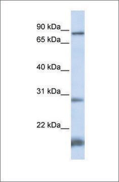 抗SMYD4抗体 ウサギ宿主抗体 affinity isolated antibody