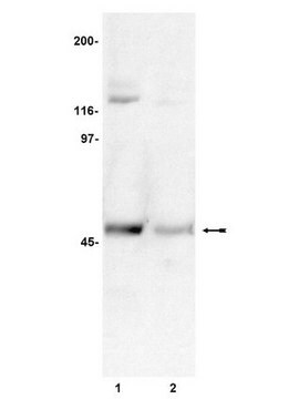 Anticuerpo anti-fosfo-CaM cinasa II, subunidad &#945;, (Thr286), clon 22B1 clone 22B1, Upstate&#174;, from mouse