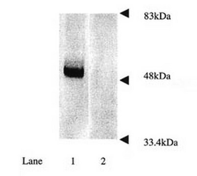 Anti-Parkin Antibody, a.a. 305-323 serum, Chemicon&#174;