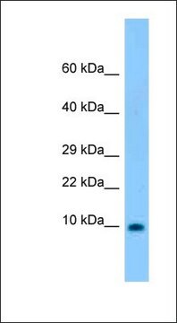 Anti-S100B antibody produced in rabbit affinity isolated antibody