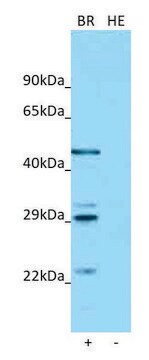 Anti-ASGR1 antibody produced in rabbit affinity isolated antibody