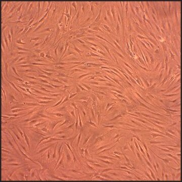 Ludzkie fibroblastopodobne synowiocyty - choroba zwyrodnieniowa stawów: HFLS-OA, dorosły