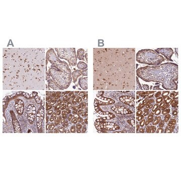 Anti-QARS antibody produced in rabbit Prestige Antibodies&#174; Powered by Atlas Antibodies, affinity isolated antibody, buffered aqueous glycerol solution