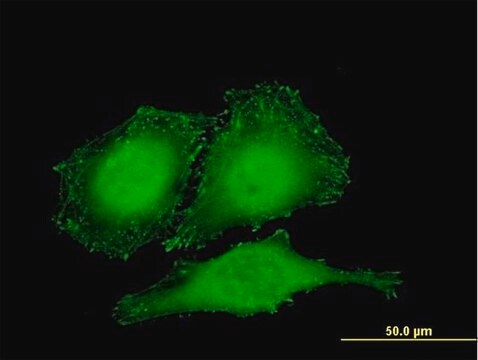 Monoclonal Anti-ZYX antibody produced in mouse clone 2C10-4A7, purified immunoglobulin, buffered aqueous solution