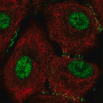 Anty-DPH1 Prestige Antibodies&#174; Powered by Atlas Antibodies, affinity isolated antibody