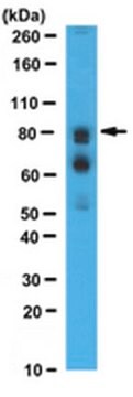 Anti-WAC-Antikörper, N-Terminus from rabbit, purified by affinity chromatography