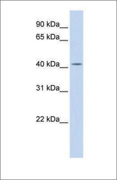 抗DHDDS抗体 ウサギ宿主抗体 affinity isolated antibody