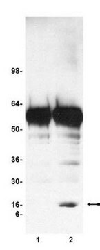 染色质免疫沉淀（ChIP）检测试剂盒 Contains all necessary reagents to perform 22 individual chromatin immunoprecipitation (ChIP) reactions using inexpensive protein A agarose beads.