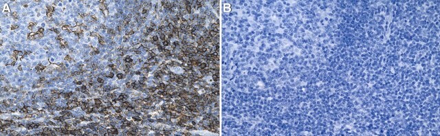 Anti-PSGL-1/CD162 Antibody, clone KPL-1 ZooMAb&#174; Mouse Monoclonal recombinant, expressed in HEK 293 cells