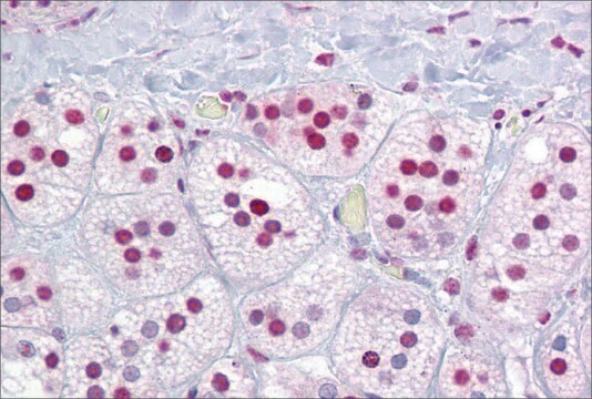 抗RORA抗体 (ab3) ウサギ宿主抗体 affinity isolated antibody