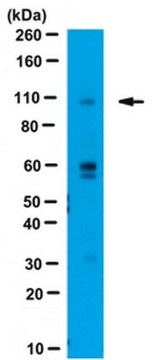 Anticorpo anti-WWP2 from rabbit, purified by affinity chromatography