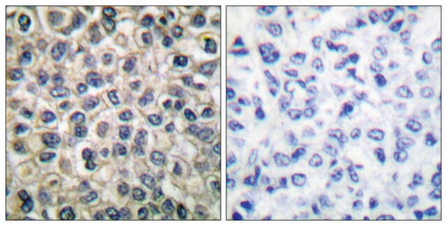 Anti-Catenin-&#947; antibody produced in rabbit affinity isolated antibody