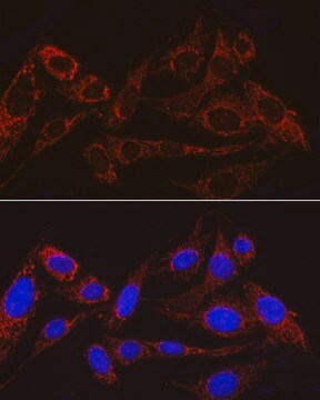 Anti-MRPS15 Antibody, clone 8Q8T5, Rabbit Monoclonal