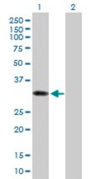 Anti-SULT1B1 antibody produced in mouse IgG fraction of antiserum, buffered aqueous solution