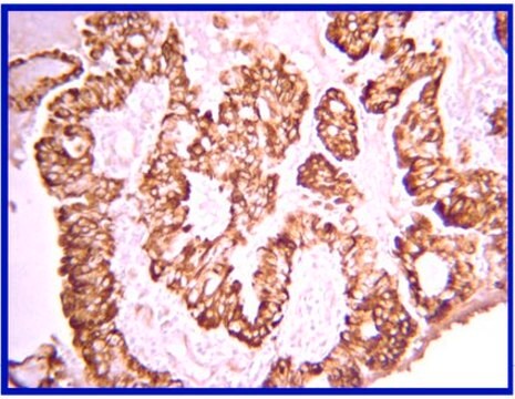 Przeciwciało anty-PDGF-AA from rabbit, purified by affinity chromatography