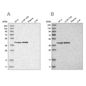 抗ERAL1抗体 ウサギ宿主抗体 Prestige Antibodies&#174; Powered by Atlas Antibodies, affinity isolated antibody, buffered aqueous glycerol solution, Ab1