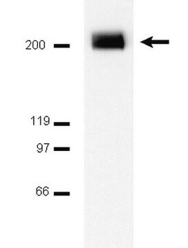 Anti-PDGFR&#946; Antibody Upstate&#174;, from rabbit