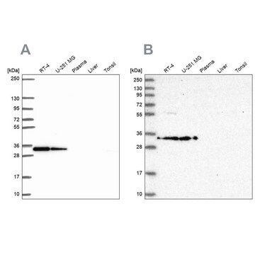 Anty-RPS3A Prestige Antibodies&#174; Powered by Atlas Antibodies, affinity isolated antibody