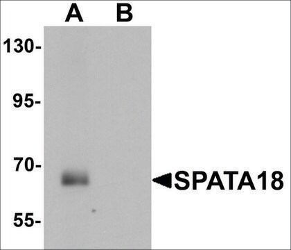 Anti-SPATA18 antibody produced in chicken affinity isolated antibody