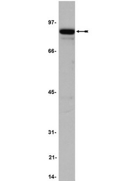 Anticuerpo anti-IKK&#945;, clon 14A231 clone 14A231, Upstate&#174;, from mouse