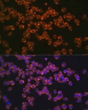 Anti-CD127/IL7R antibody produced in rabbit