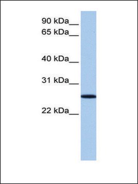 Anti-FBXO36 antibody produced in rabbit affinity isolated antibody