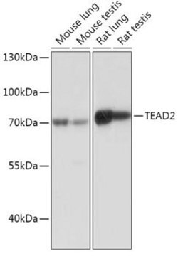 Anti-TEAD2 antibody produced in rabbit