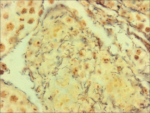 Spirochetes TISSUE-TROL&#8482; Control Slides rabbit testicle tissue containing spirochetes (Treponema pallidum)