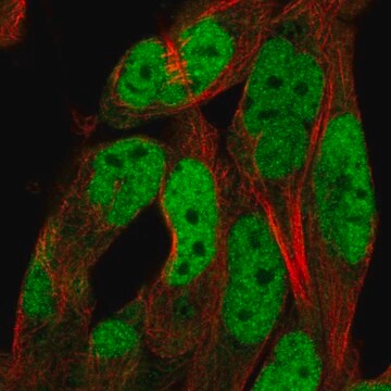 Anty-ADAMTS5 Prestige Antibodies&#174; Powered by Atlas Antibodies, affinity isolated antibody