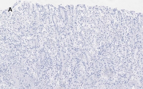 Anti-ALDH1A1 Antibody, clone 4J6, ZooMAb&#174; Rabbit Monoclonal recombinant, expressed in HEK 293 cells