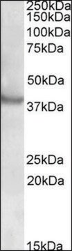 Anti-RAPSN (N-terminal) antibody produced in goat affinity isolated antibody, buffered aqueous solution