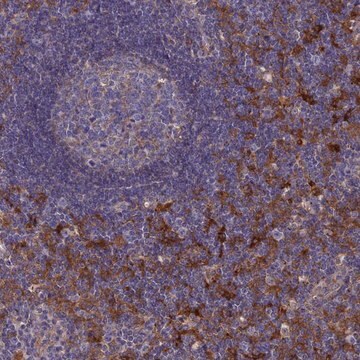 Anti-SNX11 antibody produced in rabbit Prestige Antibodies&#174; Powered by Atlas Antibodies, affinity isolated antibody, buffered aqueous glycerol solution