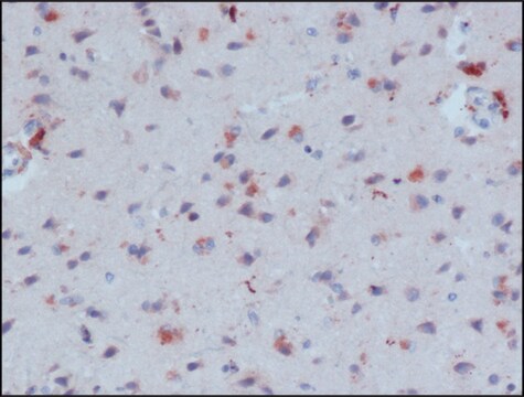 Anti-&#946;-Amyloid-Antikörper, monoklonaler Antikörper der Maus in Maus hergestellte Antikörper clone NAB 228, purified from hybridoma cell culture